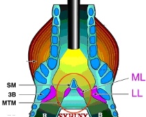 Syrinx